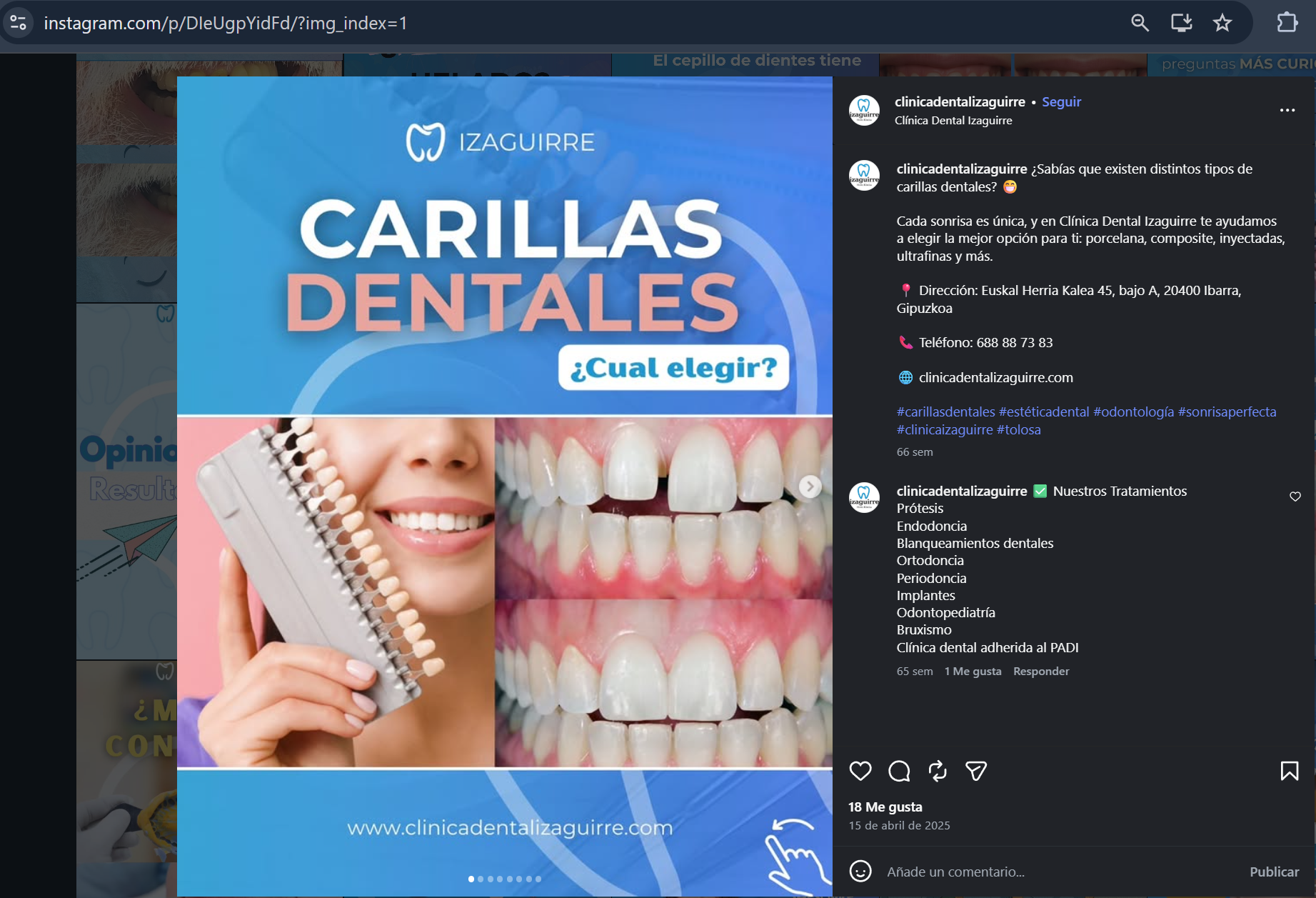 Publicación durante mi gestión · Carillas dentales